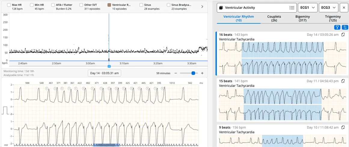 The cardiac reporting dashboard showing ECG waveforms and detected events